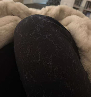 shedding faux fur blanket